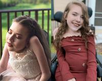 Before and after photograph.